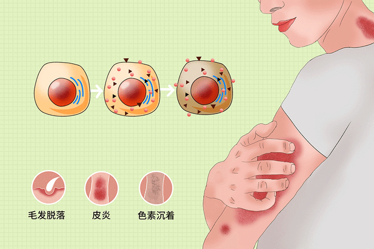 抽高仿烟 抽高仿烟会皮肤过敏吗