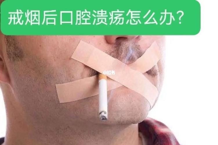 为什么香烟缓解口腔溃疡 为什么抽烟可以治疗口腔溃疡