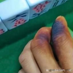 什么香烟熏手 手指烟熏