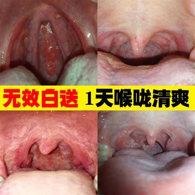 什么香烟堵嗓子好一点 什么香烟堵嗓子好一点呢