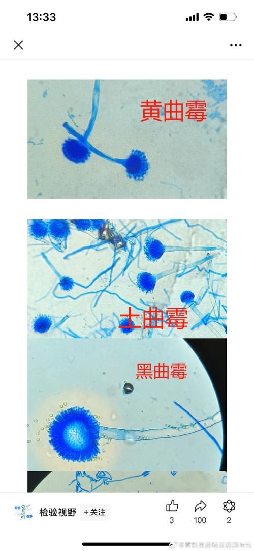 对香烟过敏的症状叫什么 对香烟过敏有什么治疗方法